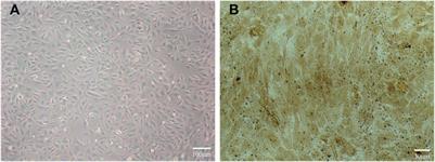 Manufacture of titanium alloy materials with bioactive sandblasted surfaces and evaluation of osseointegration properties